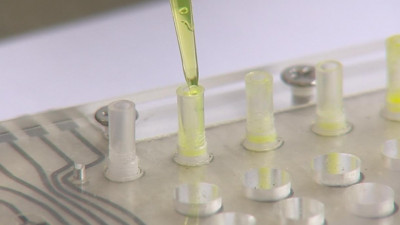 Петербургский спортсмен, заболевший коронавирусом, рассказал о симптомах