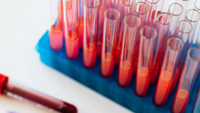 Врач рассказал, что тест на антитела не нужно сдавать до и после вакцинации