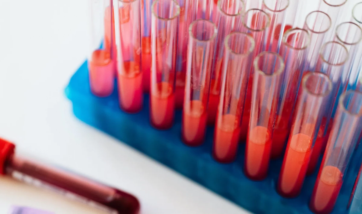 Ученые нашли антитело, которое защищает от всех известных мутаций COVID-19 - tvspb.ru