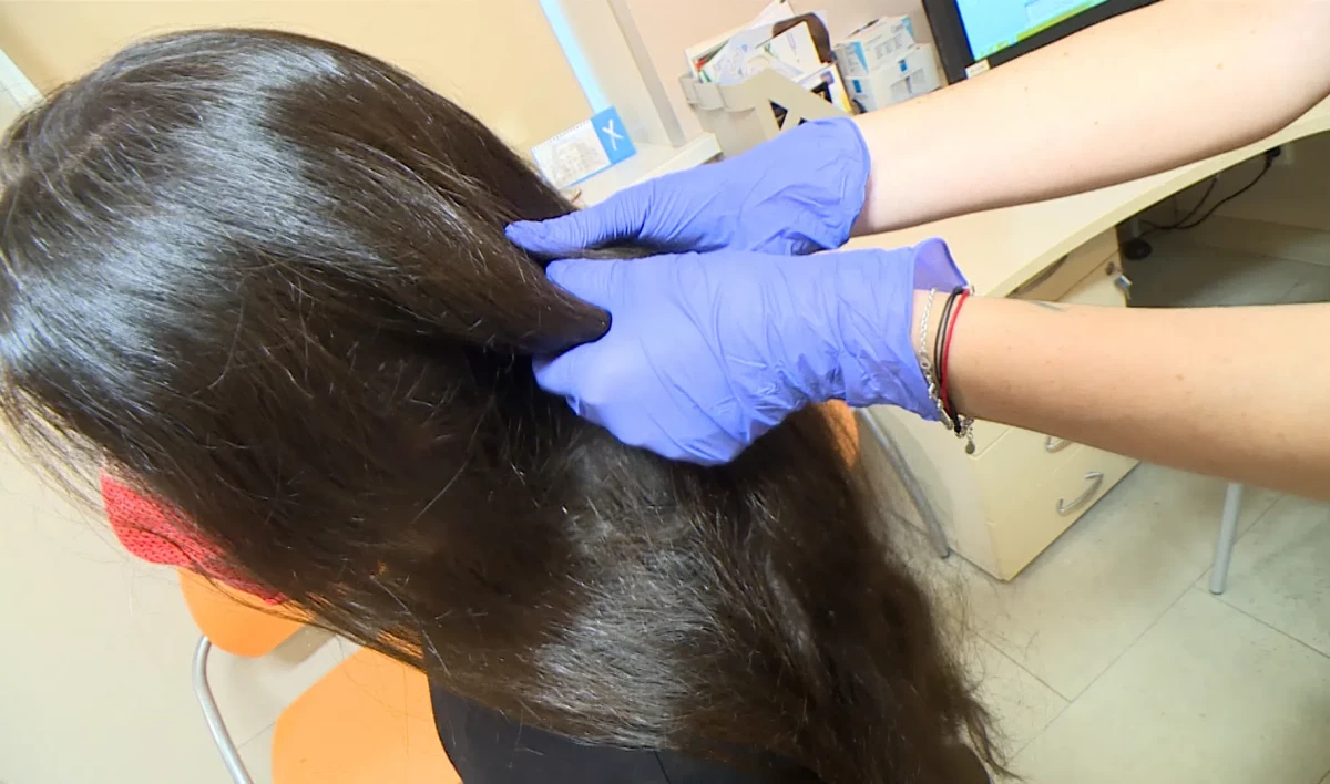 Врачи рассказали, что делать, если волосы стали выпадать после коронавируса - tvspb.ru