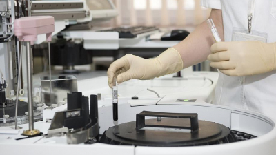 В СПбГУ открыли лабораторию, где создадут тест для выявления сахарного диабета