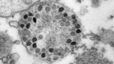 Ученые «Вектора» показали, как ведут себя клетки при заражении штаммом «омикрон»