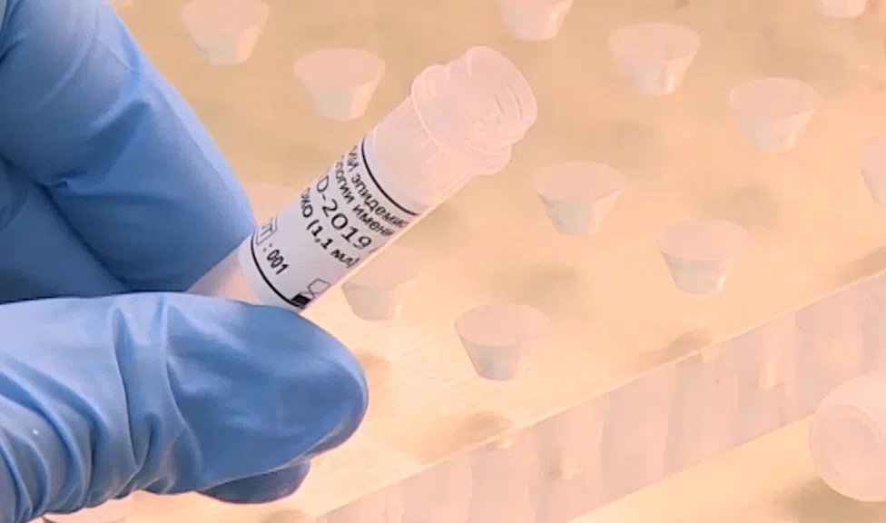 В НИИ гриппа проверили на антитела петербуржцев, вакцинировавшихся от COVID - tvspb.ru