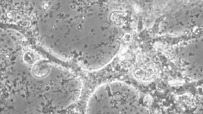 Биологи СПбГУ открыли в «сибирских джунглях» новый вид гигантской амебы