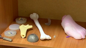 В Клинике имени Пирогова создают 3Д-модели частей тела человека