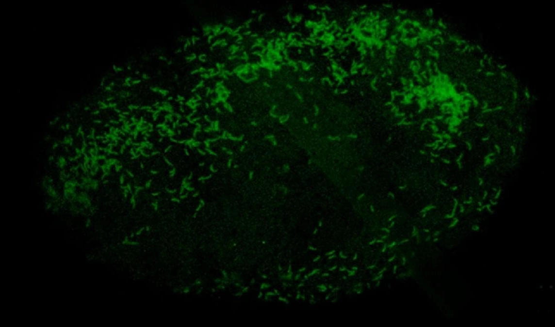 Микробиологи СПбГУ открыли первое семейство внеклеточных бактерий-паразитов - tvspb.ru