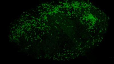Микробиологи СПбГУ открыли первое семейство внеклеточных бактерий-паразитов