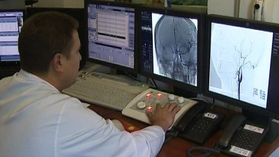 В больнице на Костюшко откроется новая рентген-операционная для лечения пациентов с ишемическим инсультом