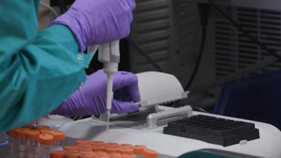 В Москве скончались еще 24 пациента с коронавирусом