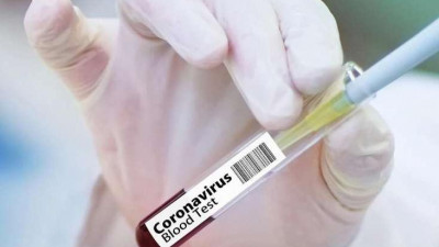 181 случай COVID-19 выявили в Петербурге за сутки