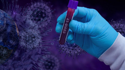 Москвичи могут подать заявку на участие в испытании вакцины от коронавируса