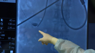 Шанс на новую жизнь: Больница Святителя Луки начинает выполнять операции по пересадке почек