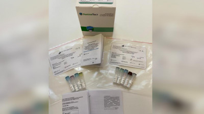 ФМБА зарегистрировало тест-систему для выявления всех штаммов коронавируса