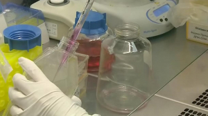 НИИ фтизиопульмонологии. Репортаж