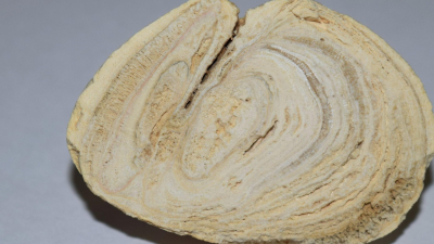 Ученые СПбГУ выясняют влияние бактериальных инфекций на образование камней в почках