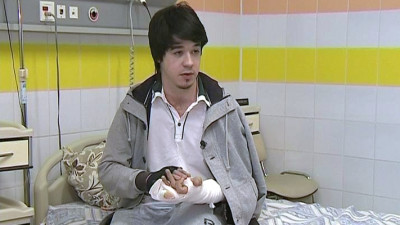 Долгий путь начинается с мизинца: петербуржцу с ожогами пересадили искусственно созданную кожу