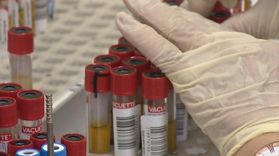 В ЛЭТИ разработали систему экспресс-диагностики и лечения коронавируса