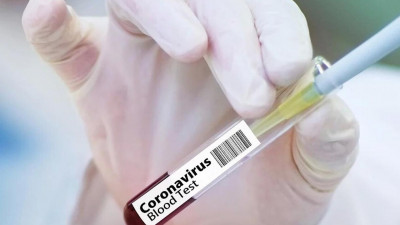 155 случаев COVID-19 выявлено в Петербурге за сутки