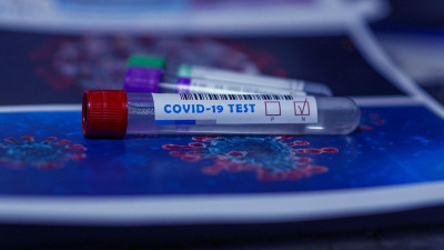 Роспотребнадзор сократил срок выполнения теста на COVID