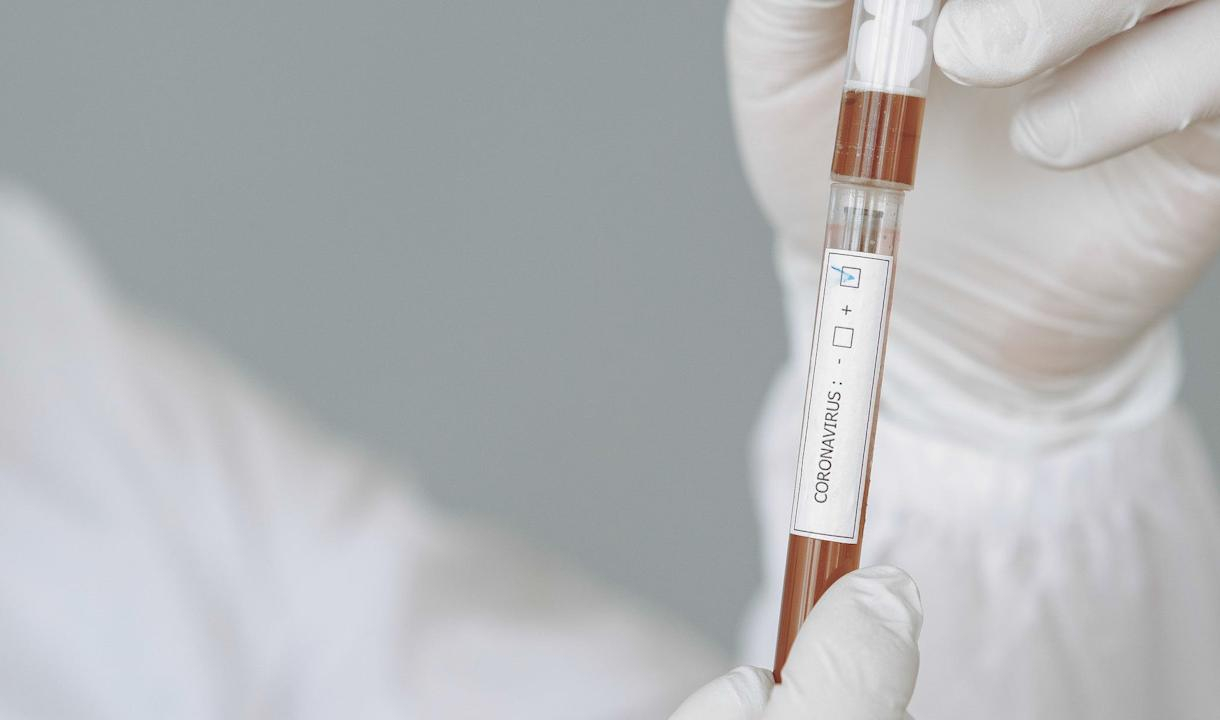 В России проведено более 18 млн тестов на наличие коронавируса