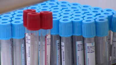 В Петербурге наблюдается устойчивый тренд на снижение заболеваемости коронавирусом