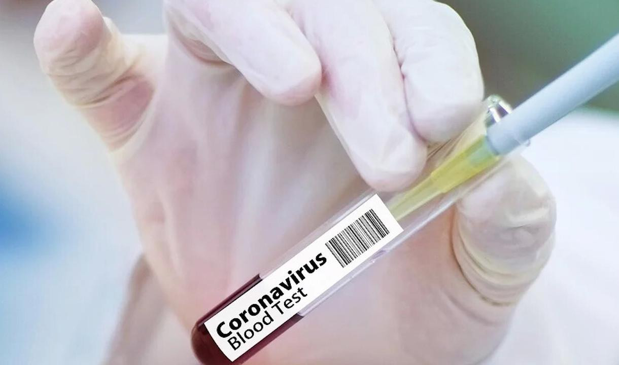 Первый больной коронавирусом появился в Петербурге в конце февраля