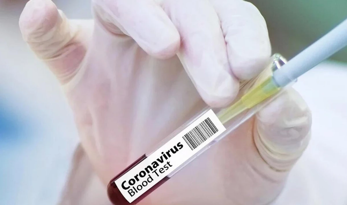 В Петербурге представили карту распространения COVID-19 по районам - tvspb.ru