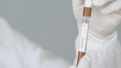 За сутки коронавирус нашли у 229 петербуржцев, выздоровели еще 498 горожан