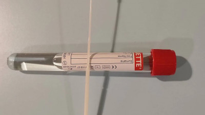 В Петербурге все ПЦР-исследования на COVID проводятся в среднем за 21 час