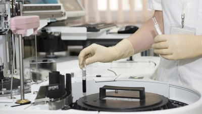 Врачи зафиксировали второй в истории случай излечения от ВИЧ