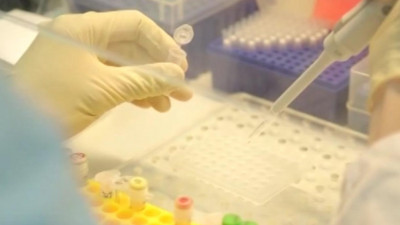 В Москве скончались еще 35 пациентов с коронавирусом