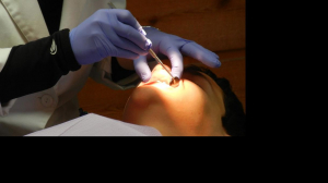 Чем опасен кариес и как часто петербуржцы водят своих детей к стоматологу?