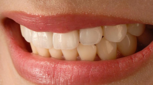 Как сохранить свои зубы здоровыми?