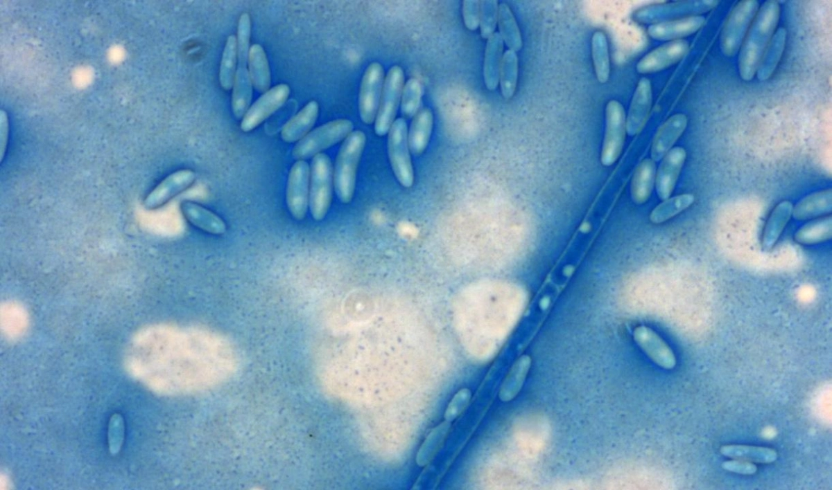 Ученые впервые в мире расшифровали геном льняного гриба-паразита, который уничтожает лен - tvspb.ru