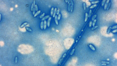 Ученые впервые в мире расшифровали геном льняного гриба-паразита, который уничтожает лен