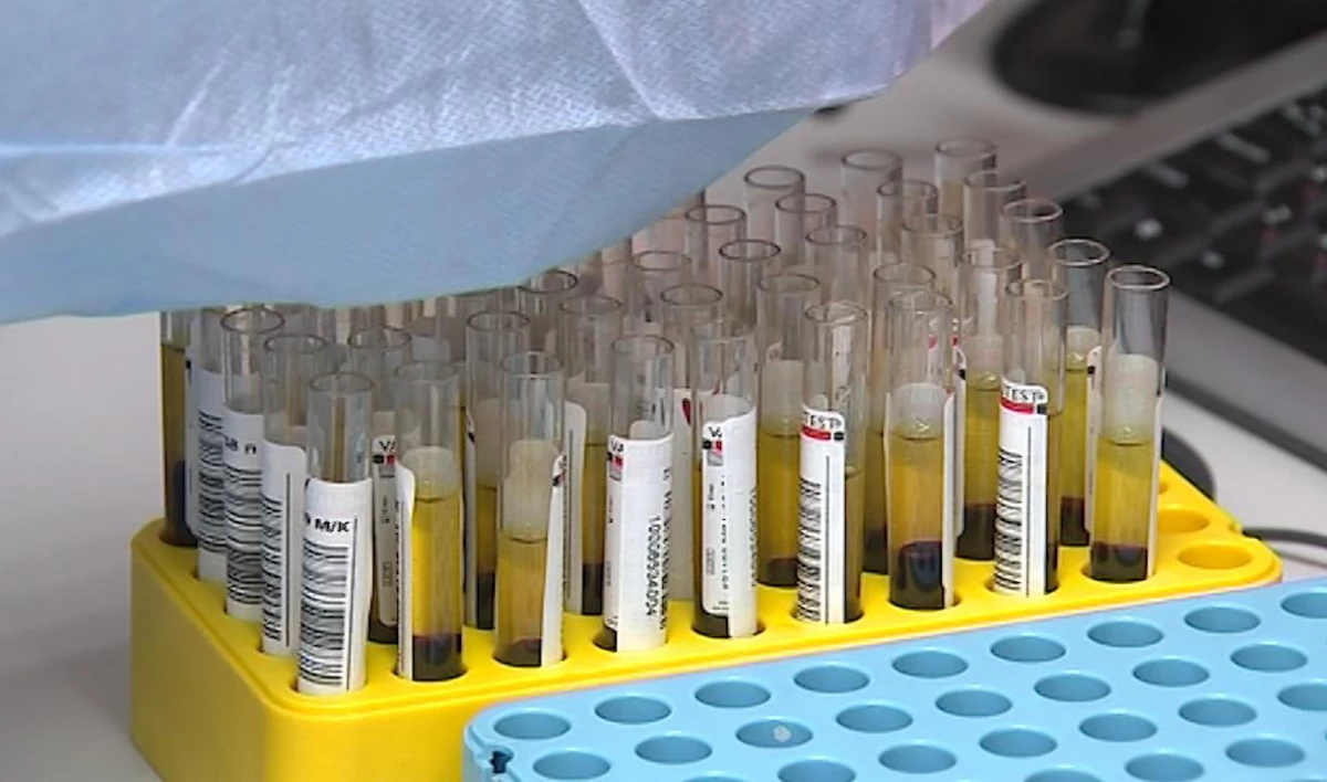 Ученые доказали связь коронавируса с группой крови - tvspb.ru