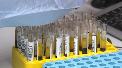 В Петербурге выявили 3 341 новый случай COVID