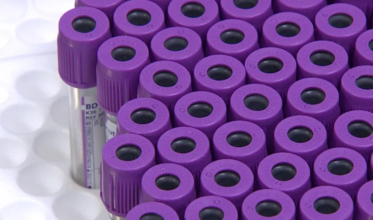 В Роспотребнадзоре объяснили колебания числа зараженных COVID-19 - tvspb.ru