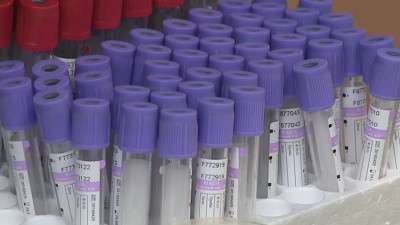 В Петербурге число заболевших COVID-19 за неделю снизилось почти на 17%