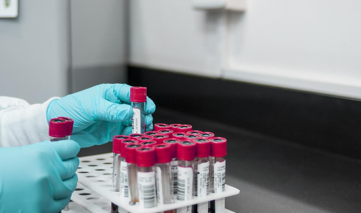 За сутки в стране сделали более 169 тысяч тестов на коронавирус