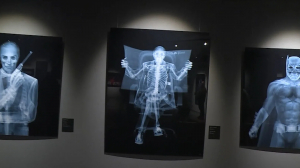 Искусство с элементами судебно-медицинской экспертизы: выставка «X-Ray Men» в Эрарте