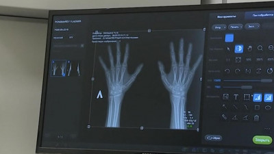 В Петербурге разработали отечественный высоковольтный источник питания для рентгеноборудования