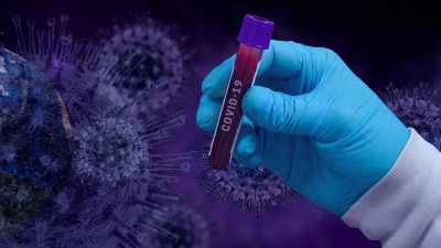 Ученые СПбГУ и РАН изучают способ обезвредить «шипы» нового коронавируса