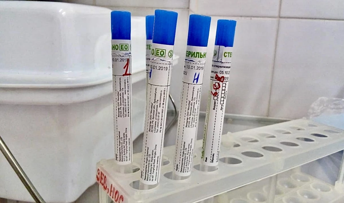 В мире за сутки выявлено более 800 тысяч случаев COVID-19 - tvspb.ru