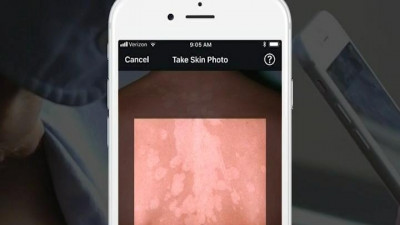Врачи смогут диагностировать заболевание с помощью смартфона