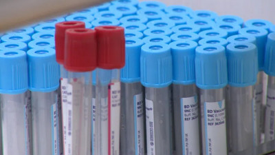 Число новых случаев COVID в Петербурге увеличилось на четверть за неделю