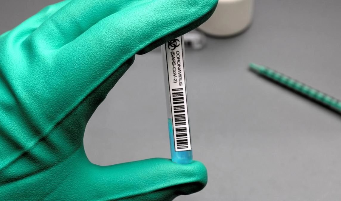 В работе лабораторий Петербурга, тестирующих на коронавирус, нашли нарушения - tvspb.ru