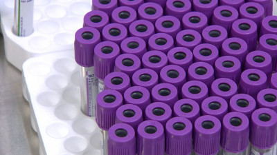 Сдавать кровь на антитела можно уже через две недели после коронавируса