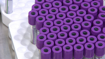 Более 667 тыс. случаев коронавируса выявили в мире за сутки