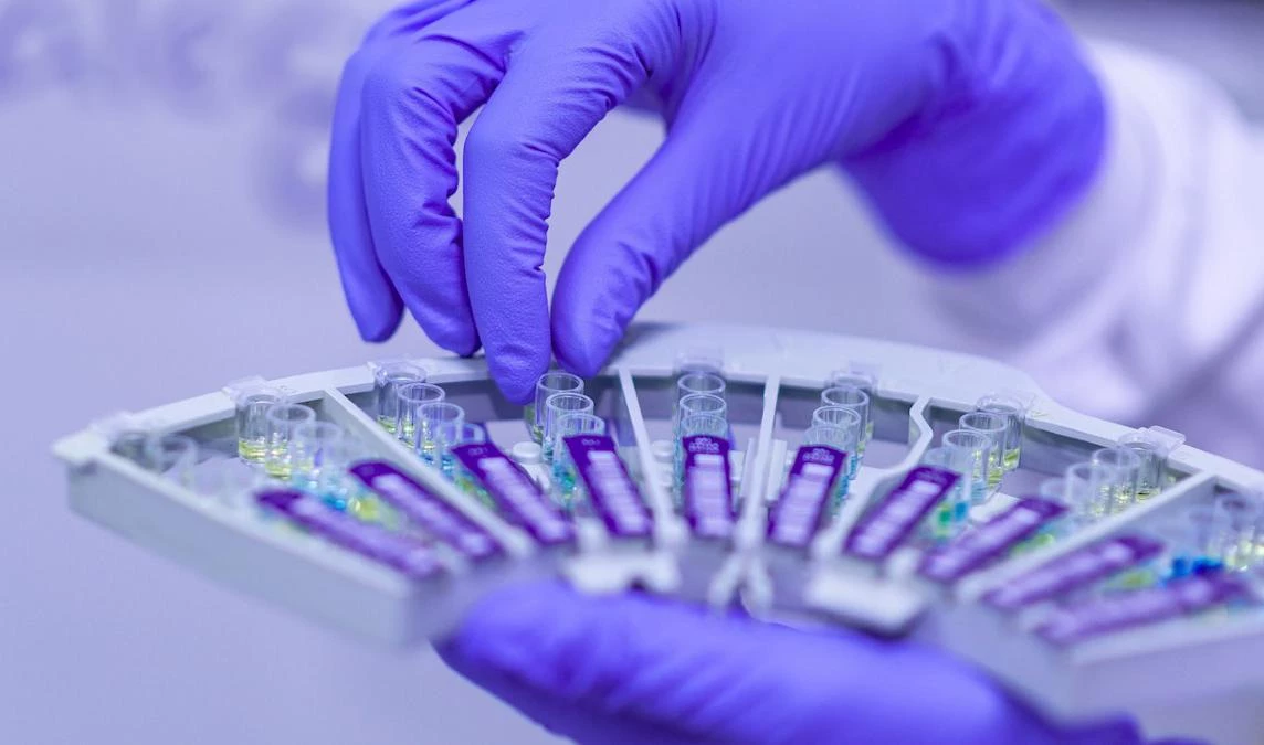 В Петербурге разработали первую тест-систему для определения антител к COVID - tvspb.ru